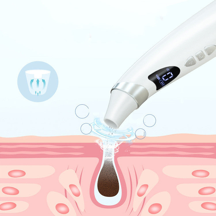 Electric Blackhead Suction Tool – Pore Cleaner for Deep Skin Cleansing
