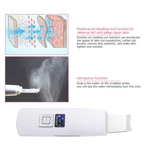 Ultrasonic Facial Cleanser – Blackhead & Acne Removal, Vibration Massager, Ultrasound Peeling Machine
