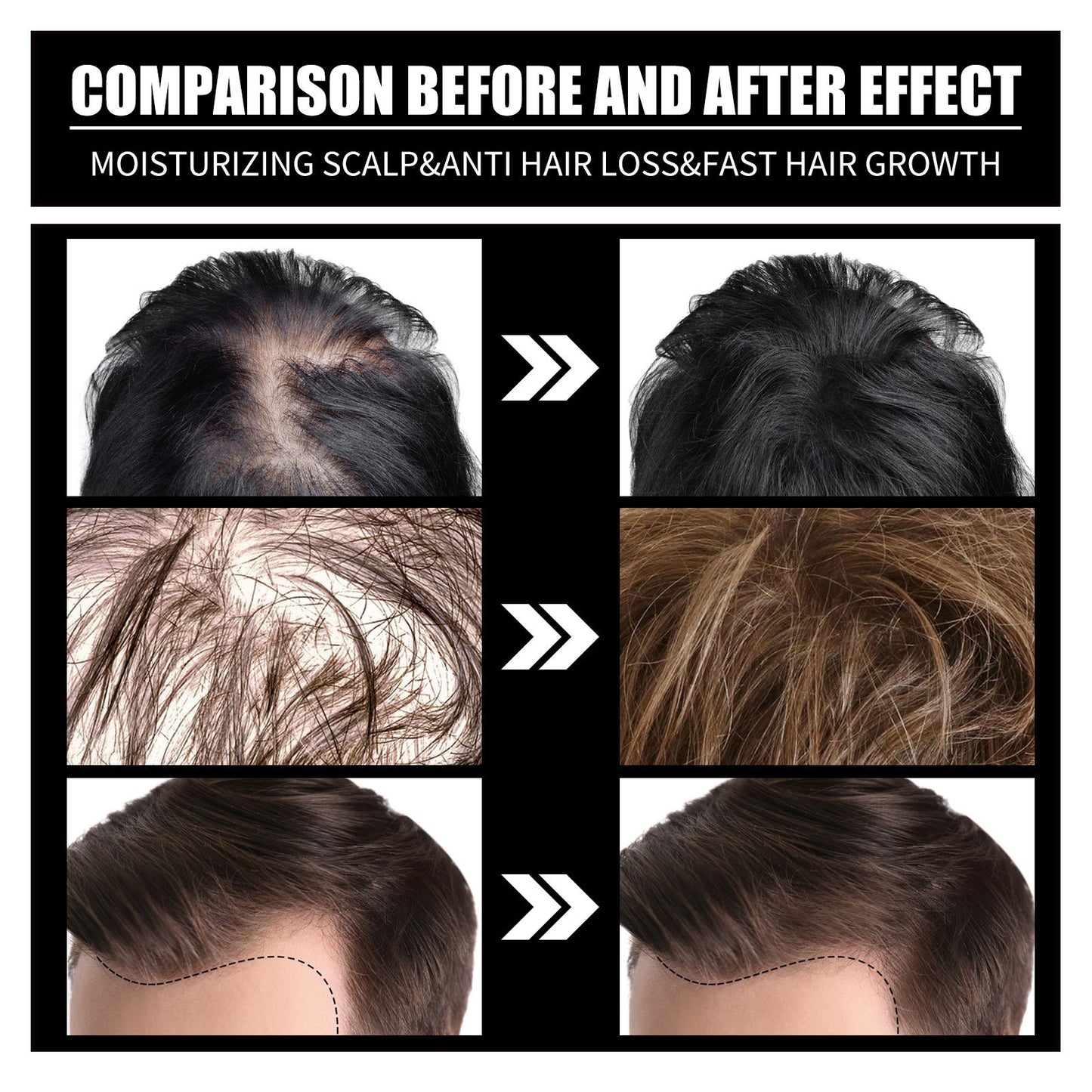 Liquid Biotin & Collagen Hair Growth Drops – Supports Healthy Hair, Skin & Nails for Men & Women