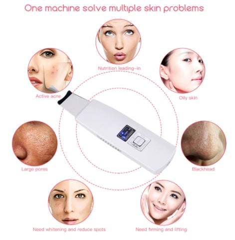 Ultrasonic Facial Cleanser – Blackhead & Acne Removal, Vibration Massager, Ultrasound Peeling Machine