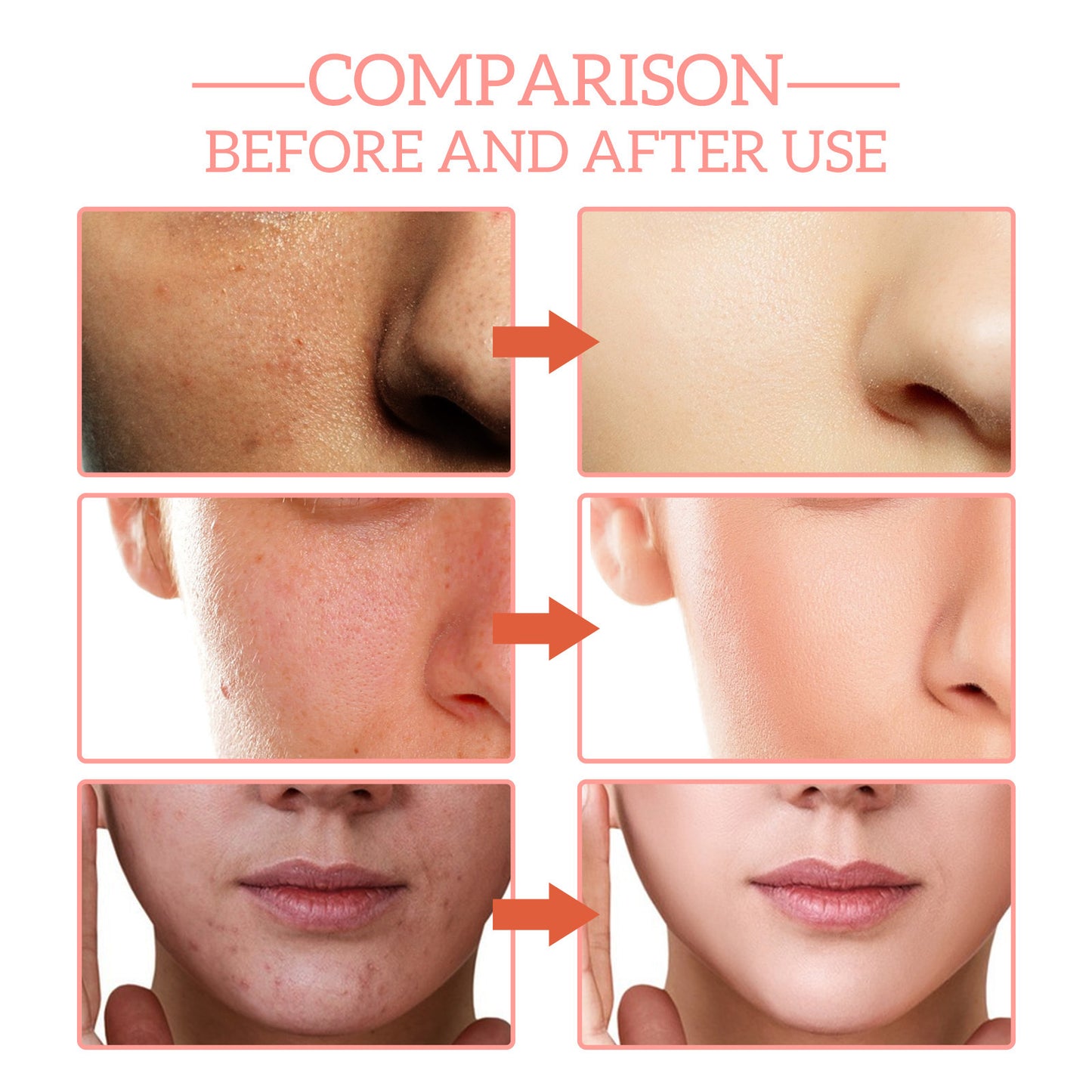 5-in-1 Vitamin C Facial Serum – Anti-Aging, Wrinkle Reduction with Hyaluronic Acid, Niacinamide & Vitamin E