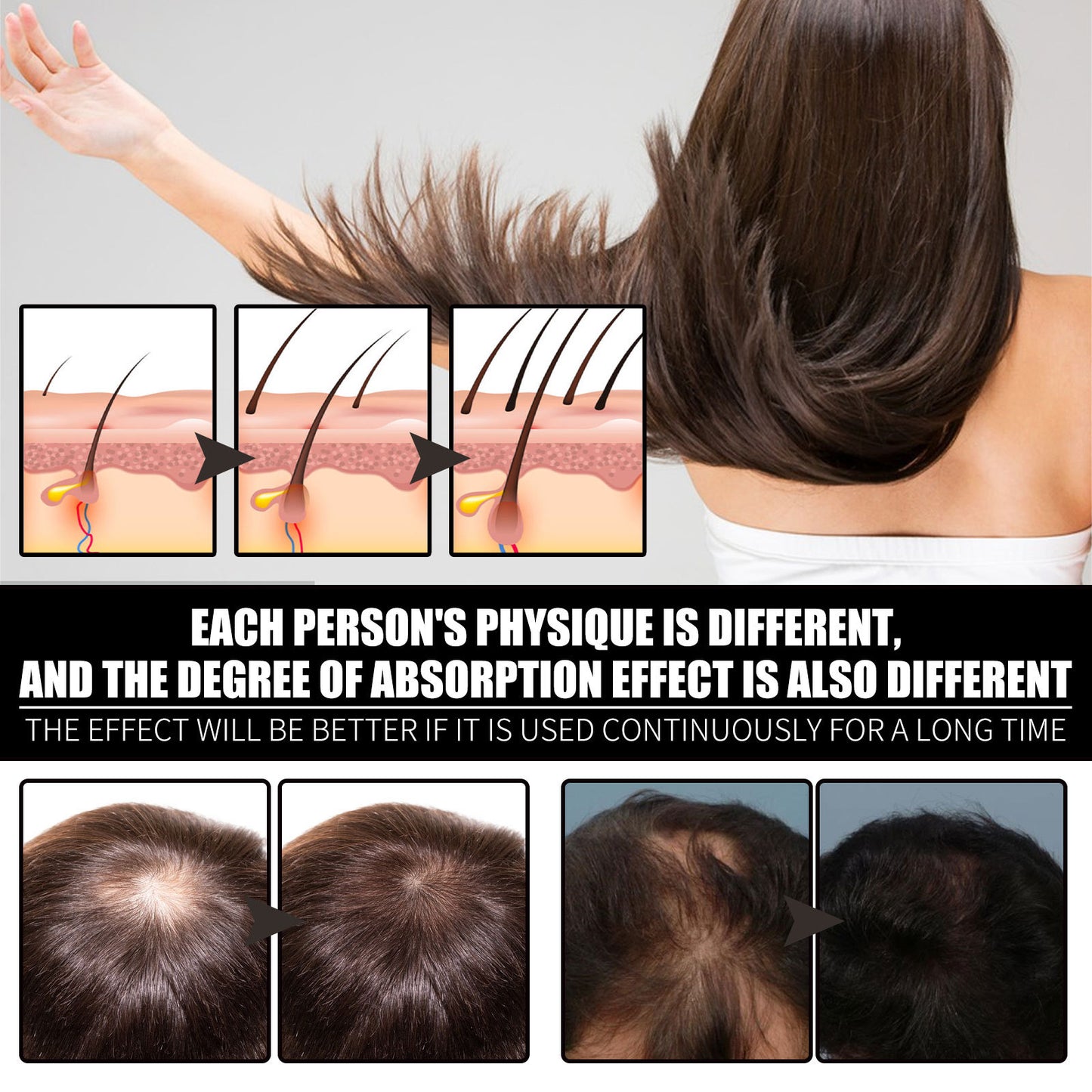 Liquid Biotin & Collagen Hair Growth Drops – Supports Healthy Hair, Skin & Nails for Men & Women