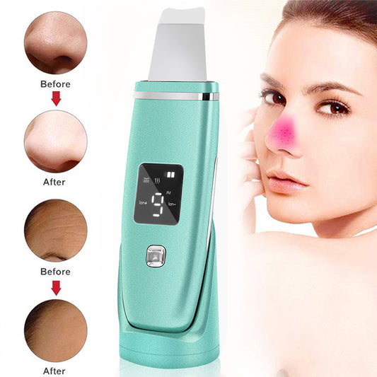 Ultrasonic Blackhead Remover – Deep Pore Cleaner with LED & Vibration